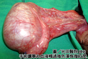 忽冷忽熱溫差大　帥哥蛋蛋險不保！
