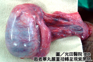 忽冷忽熱溫差大　帥哥蛋蛋險不保！