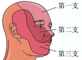 淺談三叉神經痛之針灸治療