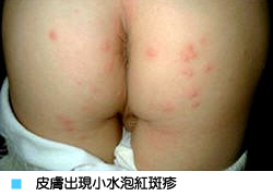 天天洗手病菌快走　腸病毒遠離我！