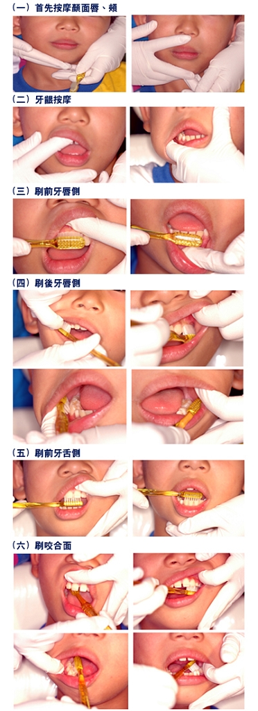 身心障礙者的口腔保健