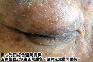 拒絕翻白眼　紳士破除30年白眼魔咒
