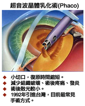 婦罹白內障10年近全盲　術後視力大大恢復