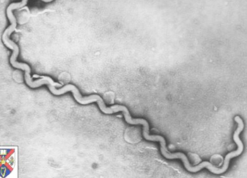 男溪邊戲水完發燒、腎功能異常　竟感染鉤端螺旋體