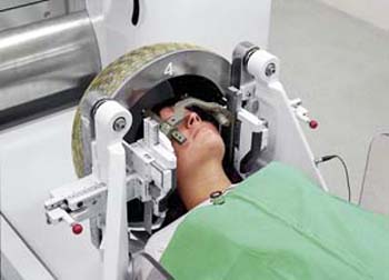 印尼女腦動靜脈血管畸型　加馬刀手術治癒