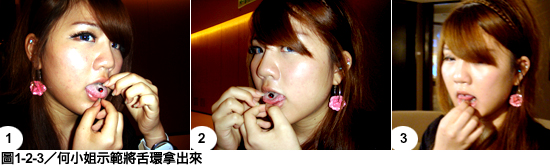 17歲少女戴舌環導致開咬問題　中華牙醫學會籲：口腔健康一生健康！