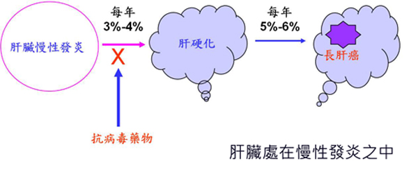 用對方法　B肝也能有好肝！