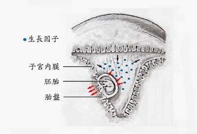 試管嬰兒療程前輕刮子宮　有利胚胎著床