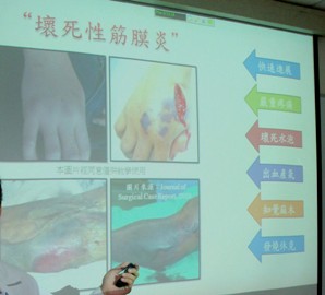 認識創傷弧菌　海洋中的無聲殺手