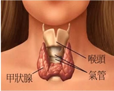 頸部疑似腫塊突起　當心為甲狀腺結節