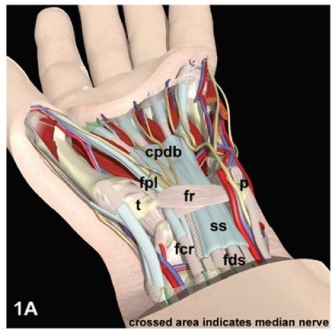 手腕長期重複動作　易造成腕隧道症候群