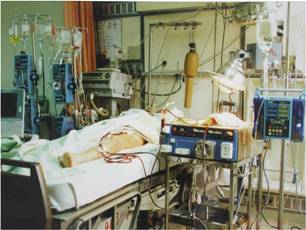 重症患者急性腎損傷的新治療　持續緩慢透析治療