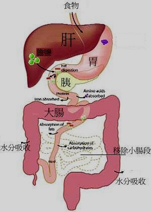 掃描小腸移植　哪些人適合手術？