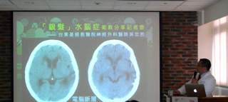 步態不穩、尿失禁、失智　當心是水腦症