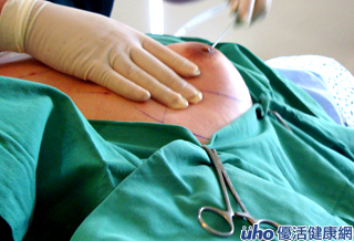 男生有女性乳房怎麼辦？！