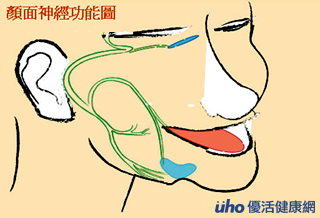 中風？壓力加熬夜，顏面神經麻痺上身