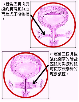 提肛运动示意图_提肛运动图解,男性提肛运动图解 ...