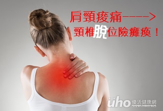 肩頸痠痛　頸椎脫位險癱瘓！