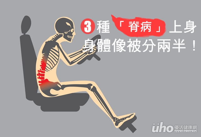 3種「脊病」上身　身體像被分兩半！