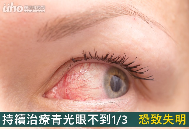 持續治療青光眼不到1/3　恐致失明