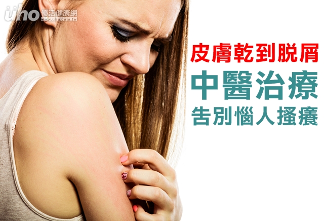 皮膚乾到脫屑　中醫治療告別惱人搔癢