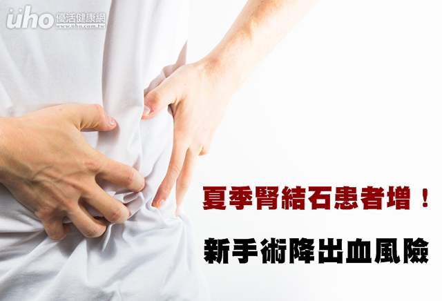 夏季腎結石患者增！新手術降出血風險
