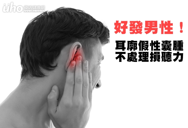 耳廓假性囊肿不处理损听力 - uho优活健康网