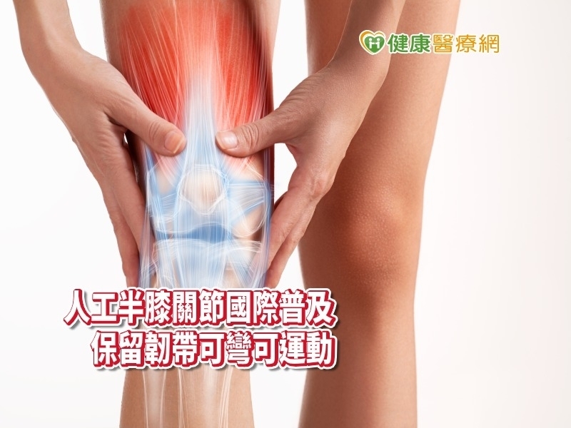 膝蓋痛吃藥、打針都無效　置換人工半膝關節「彎更多」