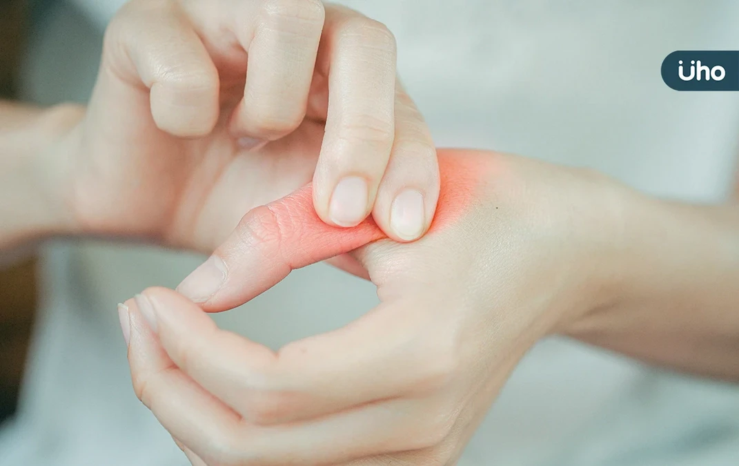天氣一冷「手指關節」就開始痛？復健醫揭「6症狀」惡化恐關節變形