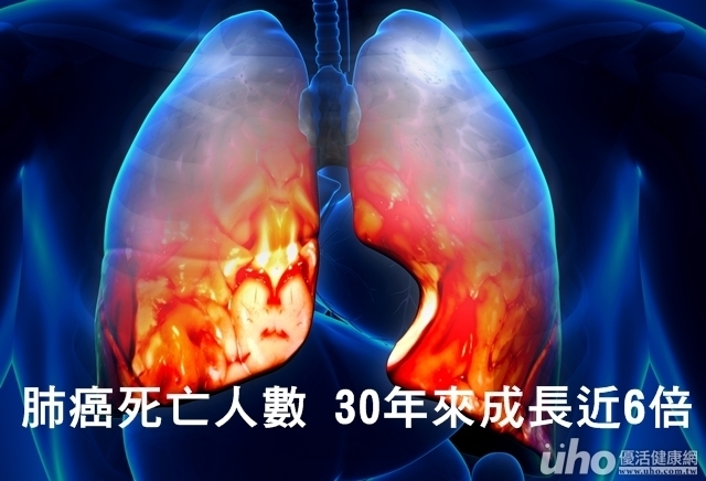 驚！肺癌死亡人數30年來成長近6倍