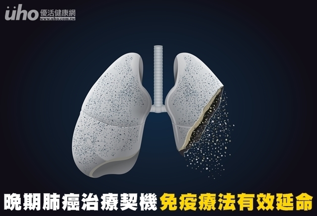 晚期肺癌治療契機　免疫療法有效延命