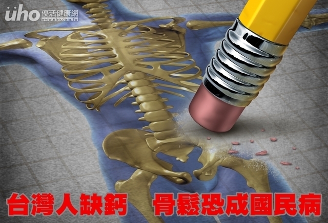 台灣人缺鈣　骨鬆恐成國民病