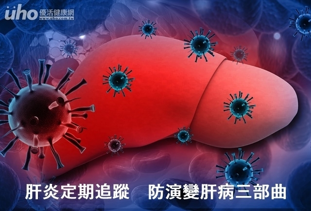 肝炎定期追蹤　防演變肝病三部曲
