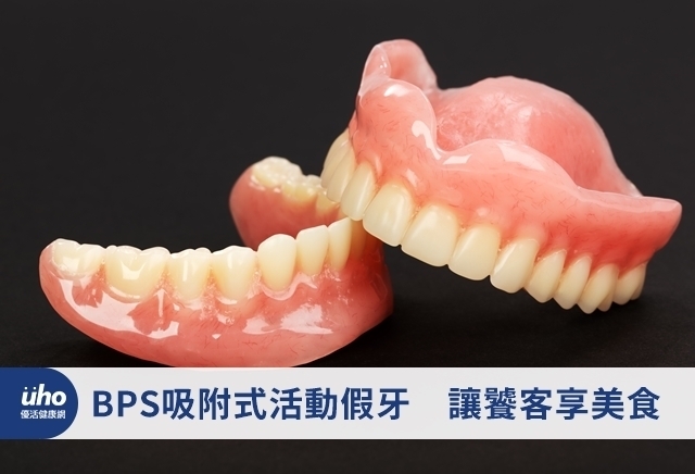 BPS吸附式活動假牙　讓饕客享美食