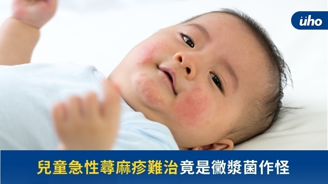兒童急性蕁麻疹難治　竟是黴漿菌作怪