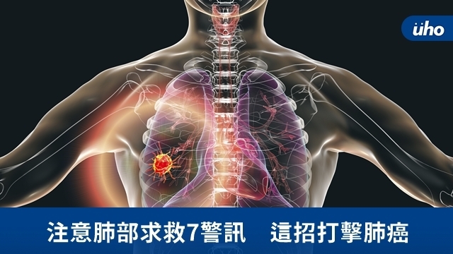注意肺部求救7警訊　這招打擊肺癌