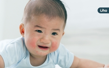 冒紅疹、長痱子⋯嬰幼兒5大「夏季皮膚病」有哪些？醫：這1種會傳染