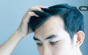 禿頭用「養髮液」有效嗎？如何選購？皮膚醫揭「2指標」才有效果