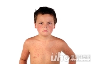 9歲童染麻疹　潛伏期曾搭高鐵！