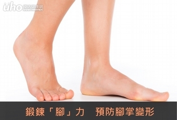 鍛鍊「腳」力　預防腳掌變形