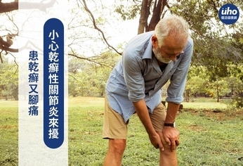患乾癬又腳痛　小心乾癬性關節炎來擾