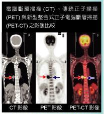 pet-ct图像-千图网