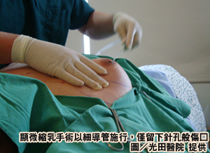 我的胸部比女友大?b罩杯帅哥缩乳展雄风