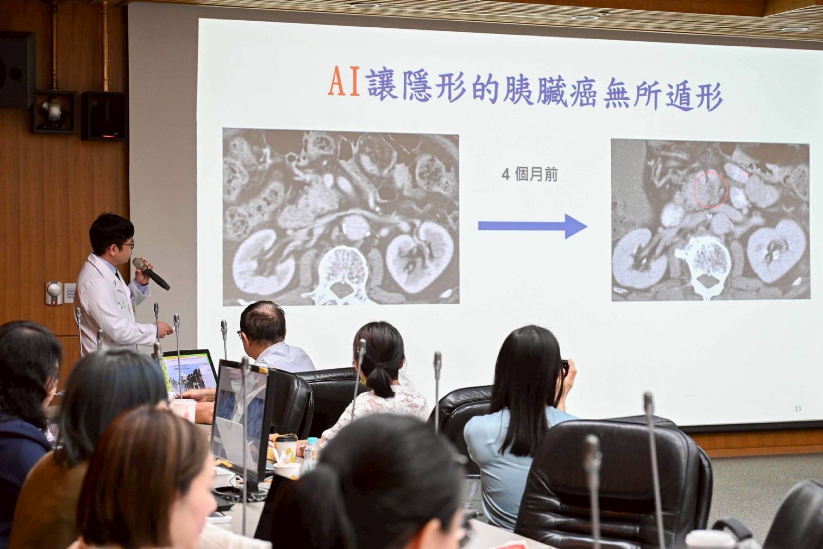 臺大醫院啟用AI 系統「助胰見」 突破胰臟癌早期診斷瓶頸