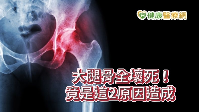 大腿骨全壞死！竟是這2原因造成　疼痛不容忽視