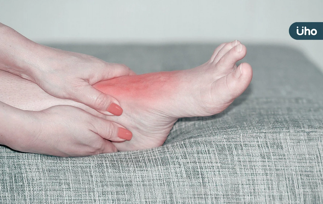 痛風可以吃海鮮、菇類嗎?營養師解析「痛風飲食地雷」1飲料千萬別喝