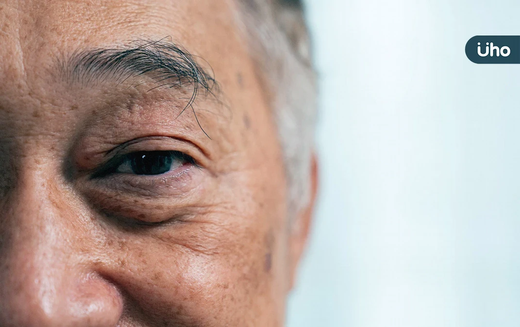 如糖果紙遮眼！黃斑部皺摺術後恢復差⋯北榮領先全球揪出「惡化關鍵」