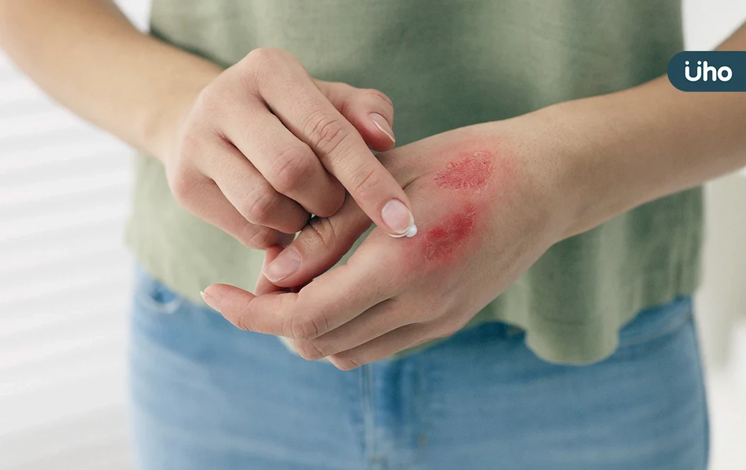 皮膚有傷口怎麼辦?如何讓傷口快速癒合?醫教「急性VS慢性」傷口照護