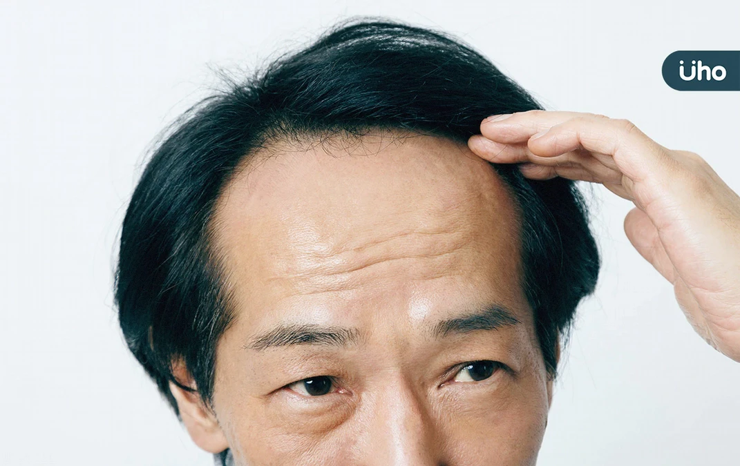 變胖、禿頭⋯好怕旁人嘲笑眼光！心理師教你「2方法」看穿容貌焦慮