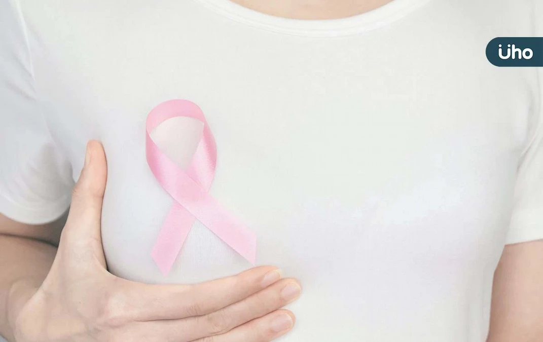 乳頭有分泌物就是乳癌嗎？黃色、 血色、 咖啡色⋯合併1狀況要小心